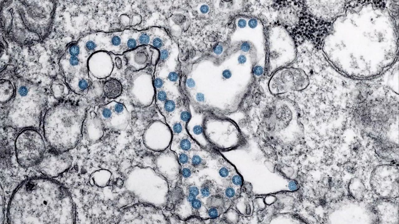 University of Kentucky Releases Coronavirus Testing Results
