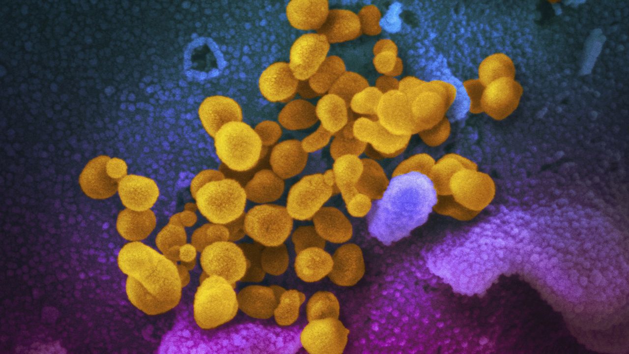 This undated, colorized electron microscope image made available by the U.S. National Institutes of Health in February 2020 shows the novel coronavirus SARS-CoV-2, indicated in yellow, emerging from the surface of cells, indicated in blue/pink, cultured in a laboratory. (NIAID-RML via AP, File) 