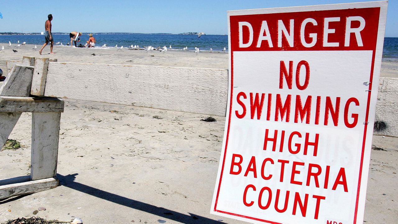 No swimming, high bacteria sign posted at a beach (AP Photo/Michael Dwyer)