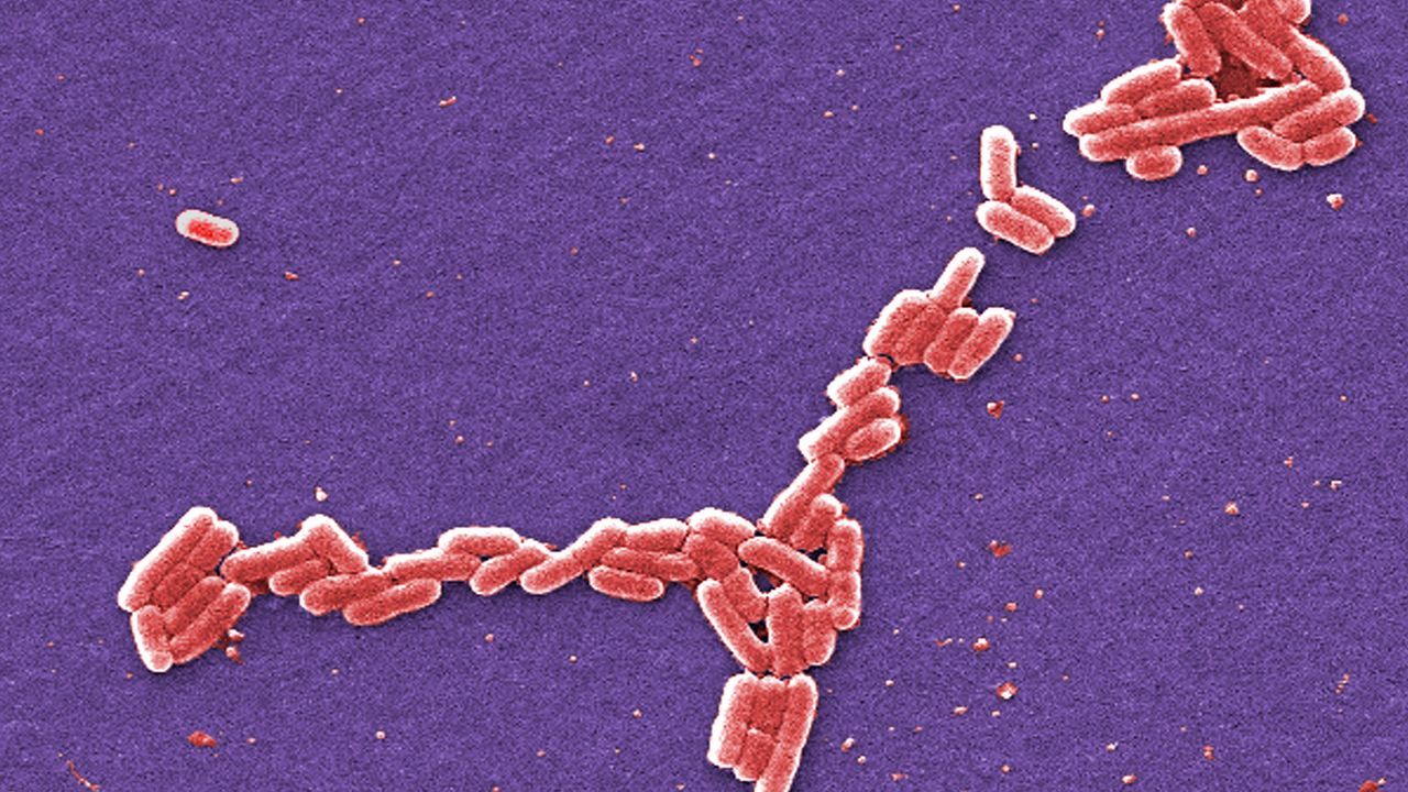 This colorized 2006 scanning electron microscope image made available by the Centers for Disease Control and Prevention shows E. coli bacteria of the O157:H7 strain that produces a powerful toxin which can cause illness.  (Janice Haney Carr/CDC via AP)