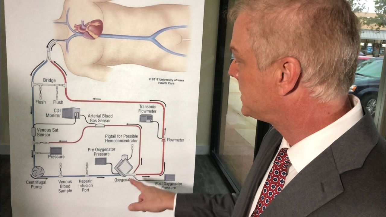 what-is-ecmo-doctor-explains-the-covid-treatment