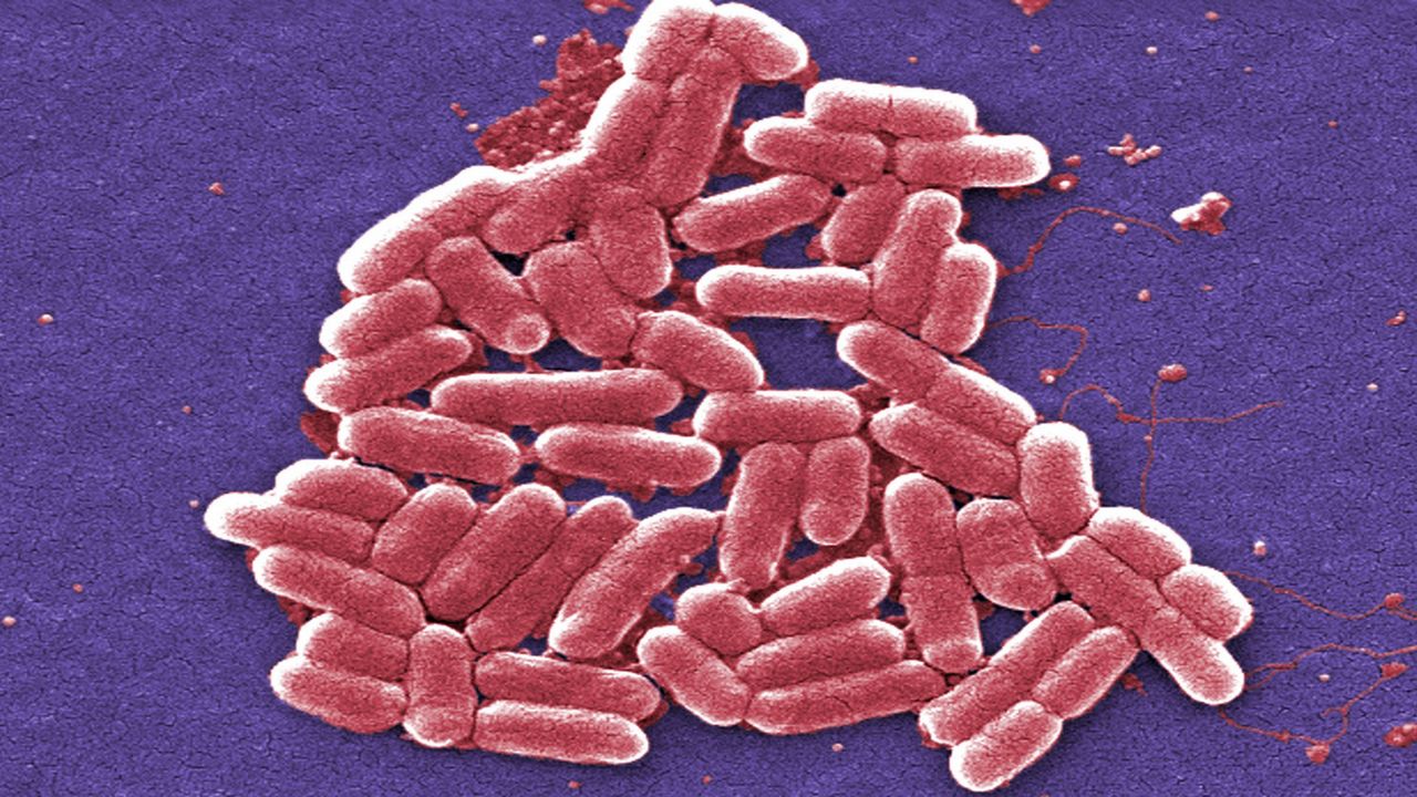 This 2006 colorized scanning electron micrograph image made available by the Centers for Disease Control and Prevention shows the O157:H7 strain of the E. coli bacteria. The St. Louis County Department of Health (DPH) is investigating an outbreak of E. coli among students and parents at Rockwood Summit High School who attended an off-campus event. (Janice Carr/CDC via AP)