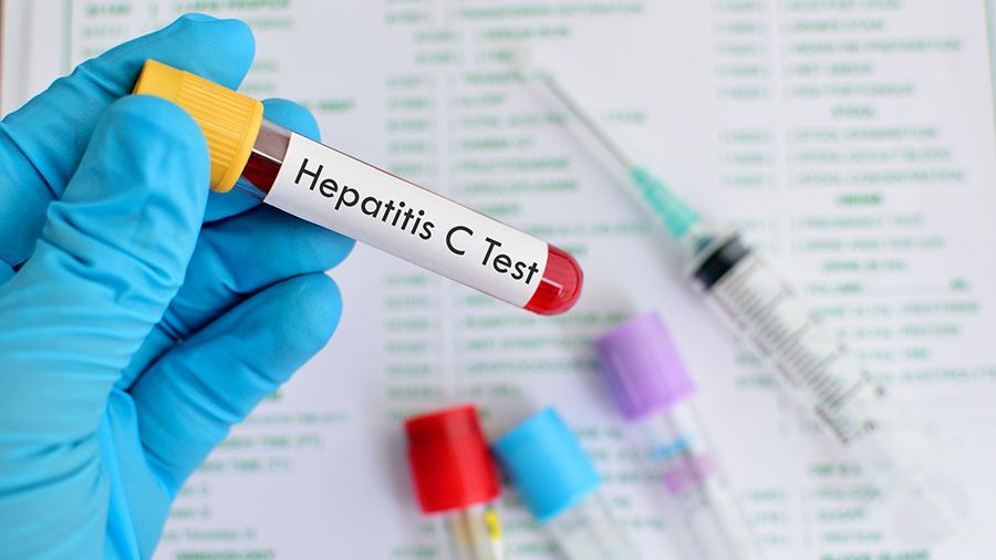 Healthcare providers are urged to opt for "reflex" hepatitis C testing to hasten the confirmation and treatment of the viral infection. (Getty Images/jarun011)