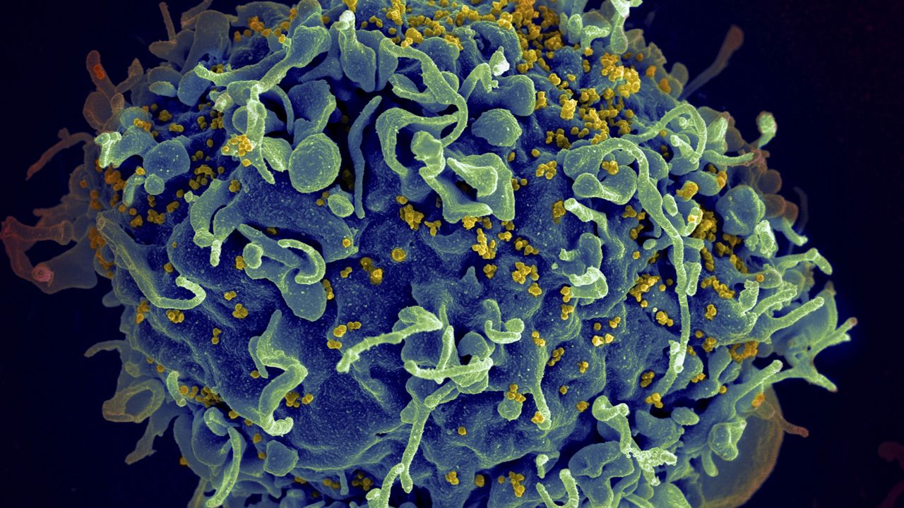 This electron microscope image made available by the U.S. National Institutes of Health shows a human T cell, in blue, under attack by HIV, in yellow, the virus that causes AIDS. (Seth Pincus, Elizabeth Fischer, Austin Athman/National Institute of Allergy and Infectious Diseases/NIH via AP, File)