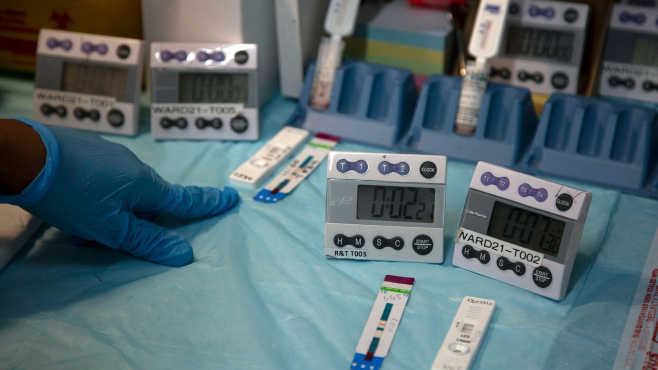 Laboratory technicians test a blood sample for HIV infection in Johannesburg. (AP Photo/Denis Farrell, File)