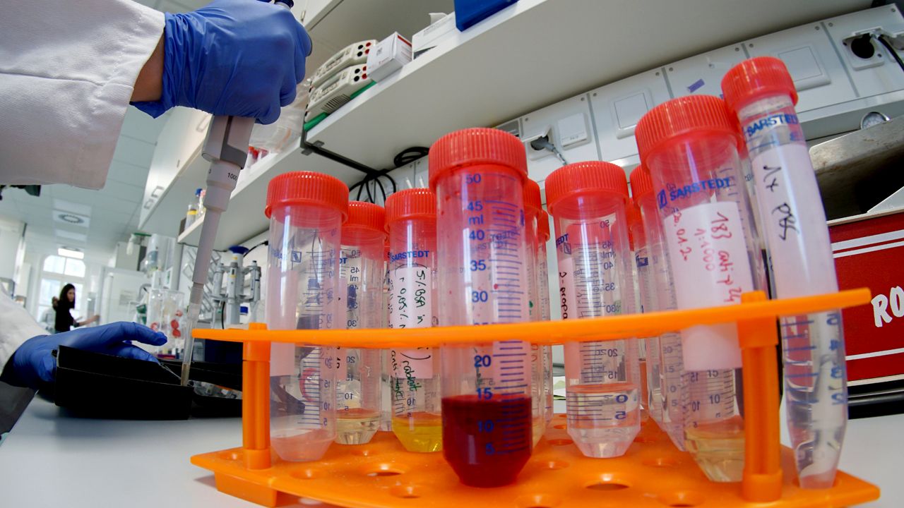 A lab assistant at Berlin's Charite hospital tests samples for research into the coronavirus in Germany on Tuesday. (Michael Sohn/AP)