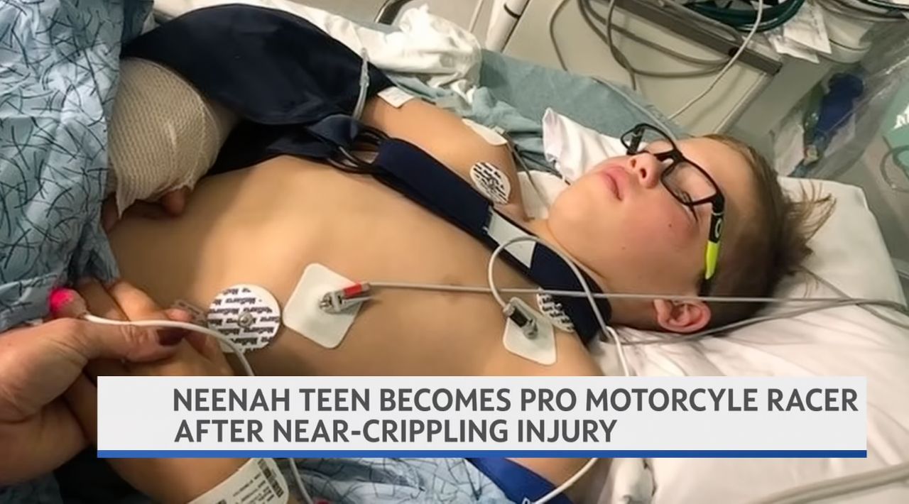 Neenah teen overcomes near-crippling injury to become pro motorcycle racer