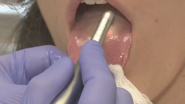 Psa Injection Site