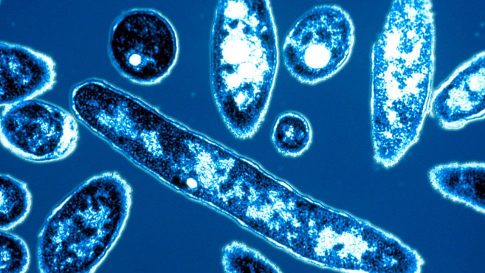 Legionnaires' disease bacteria under microscope. 