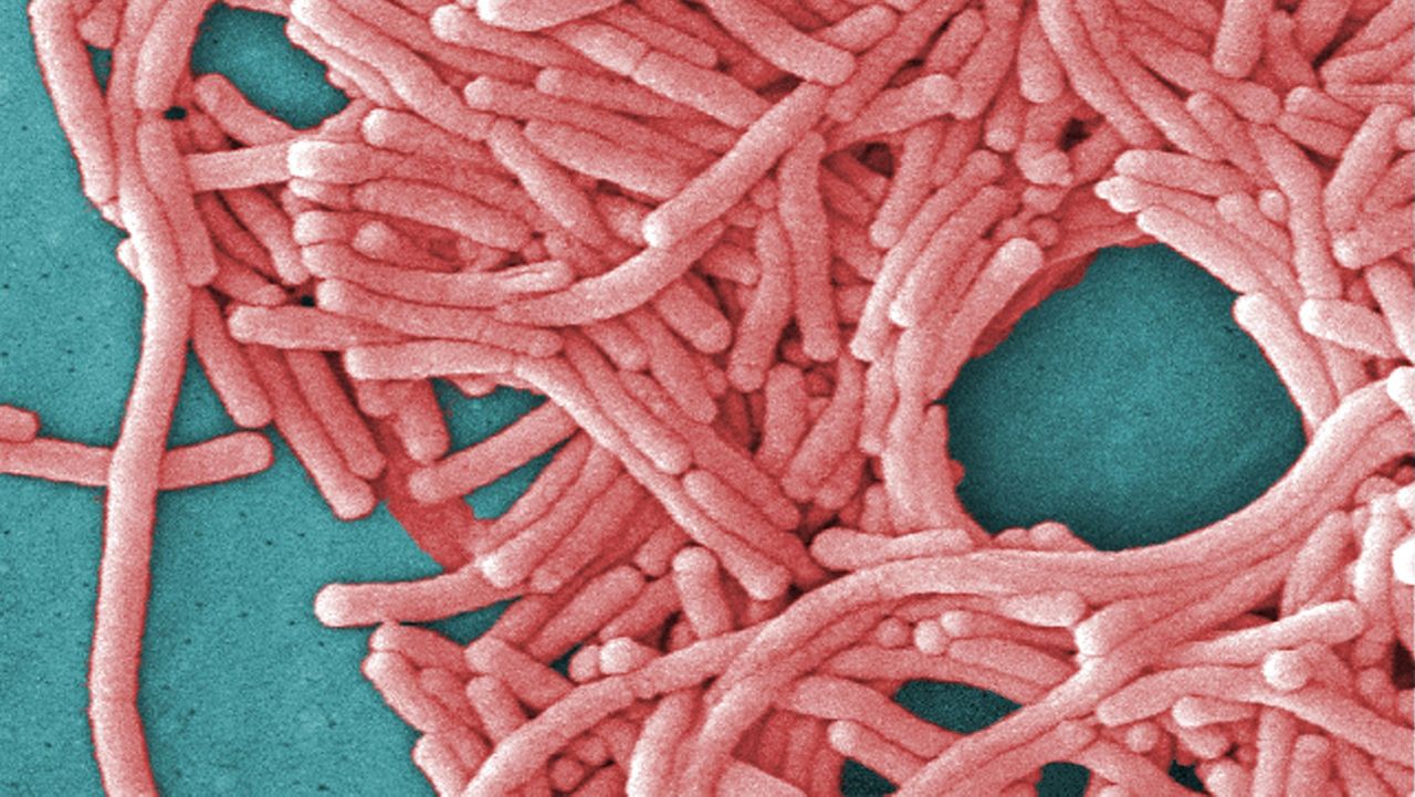 Legionnaires disease