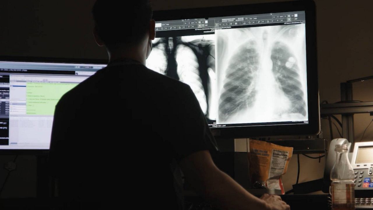 X-rays are among the services offered at the new University Hospitals location. (Spectrum News 1 File Photo)