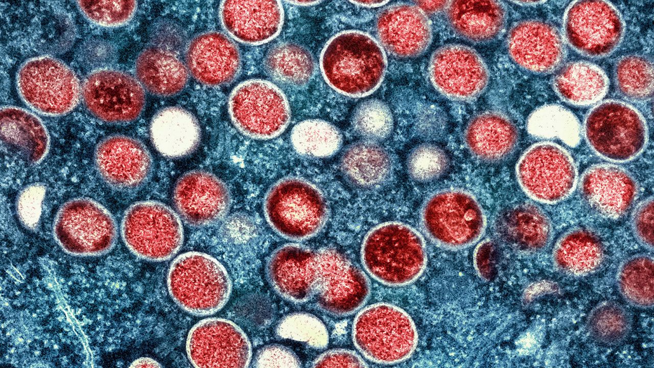 This image provided by the National Institute of Allergy and Infectious Diseases (NIAID) shows a colorized transmission electron micrograph of mpox particles (red) found within an infected cell (blue), cultured in the laboratory that was captured and color-enhanced at the NIAID Integrated Research Facility (IRF) in Fort Detrick, Md. (NIAID via AP)