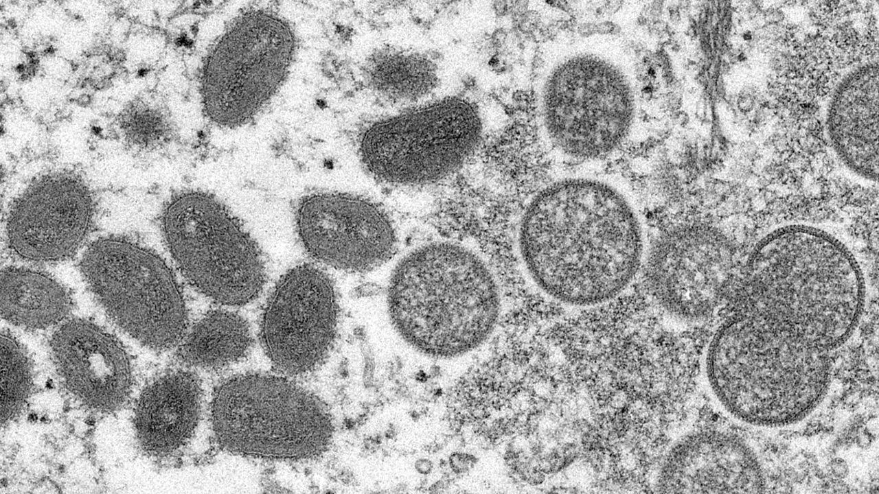 FILE - This 2003 electron microscope image made available by the Centers for Disease Control and Prevention shows mature, oval-shaped monkeypox virions, left, and spherical immature virions, right. (Cynthia S. Goldsmith, Russell Regner/CDC via AP, File)
