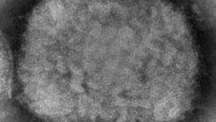 This 2003 electron microscope image shows an mpox virion obtained from a sample associated with the 2003 prairie dog outbreak.