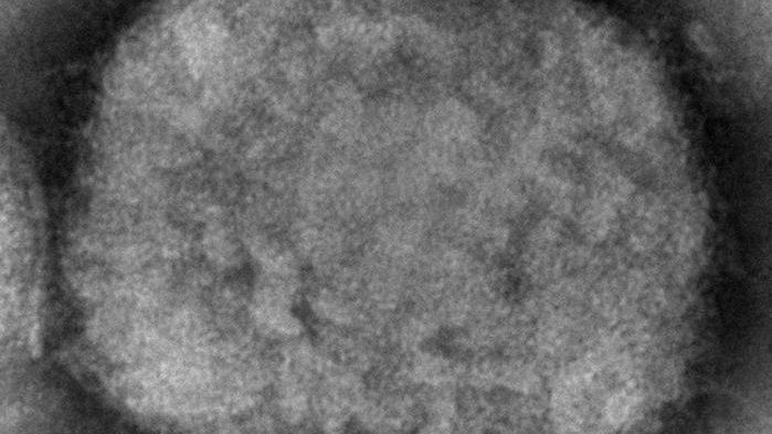 This 2003 electron microscope image made available by the U.S. Centers for Disease Control and Prevention shows a monkeypox virion, obtained from a sample associated with the 2003 prairie dog outbreak. (Cynthia S. Goldsmith, Russell Regner/CDC via AP, File)