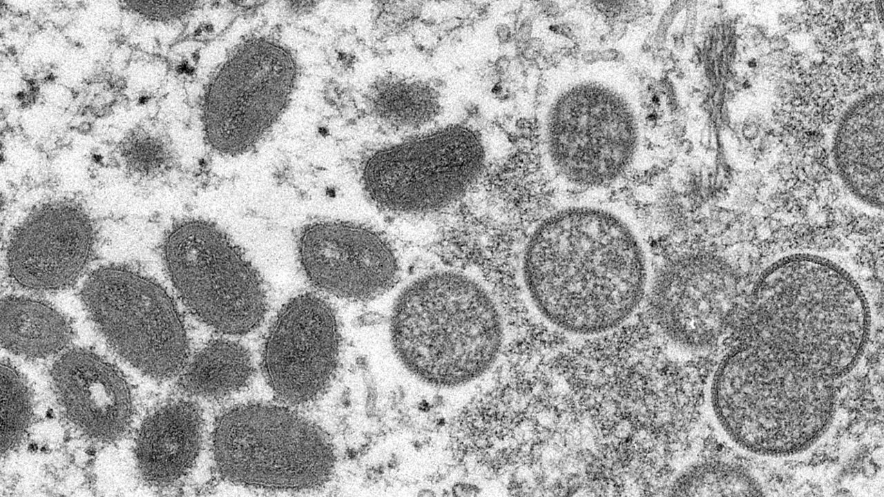 This 2003 electron microscope image made available by the Centers for Disease Control and Prevention shows mature, oval-shaped monkeypox virions, left, and spherical immature virions, right, obtained from a sample of human skin associated with the 2003 prairie dog outbreak. (Cynthia S. Goldsmith, Russell Regner/CDC via AP, File)