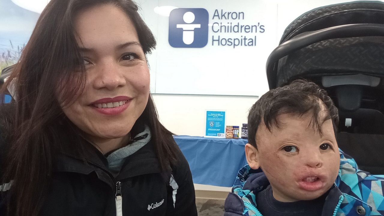 Servicio de interpretación del Akron Children’s Hospital