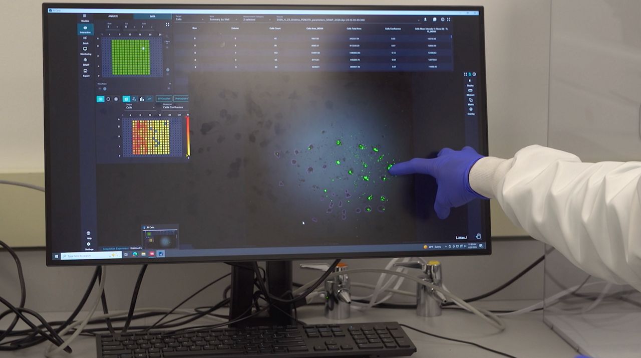 Scientists are growing 'organoids' to fight cancer