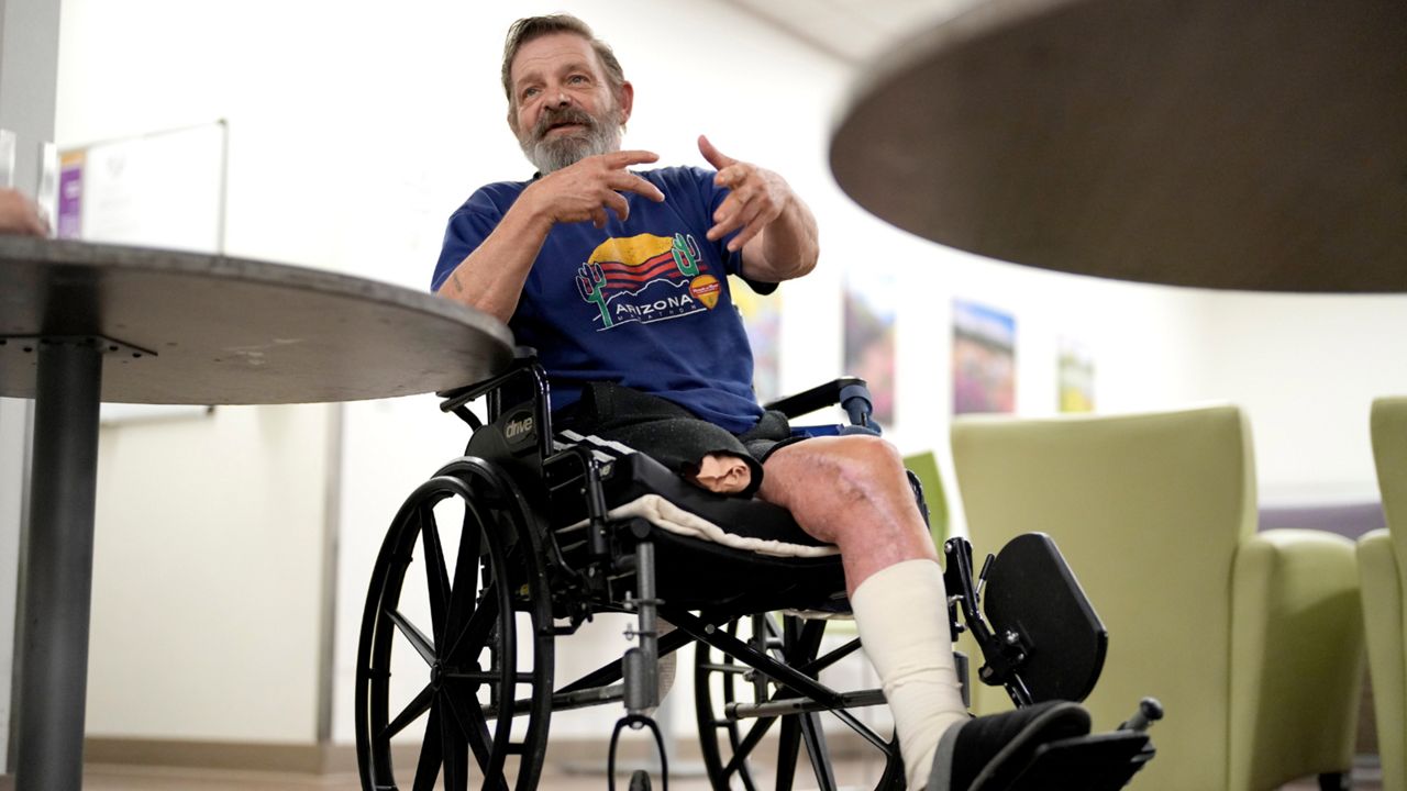 Ron Falk, 62, speaks of losing his leg, Tuesday, June 25, 2024 in Phoenix. (AP Photo/Matt York)