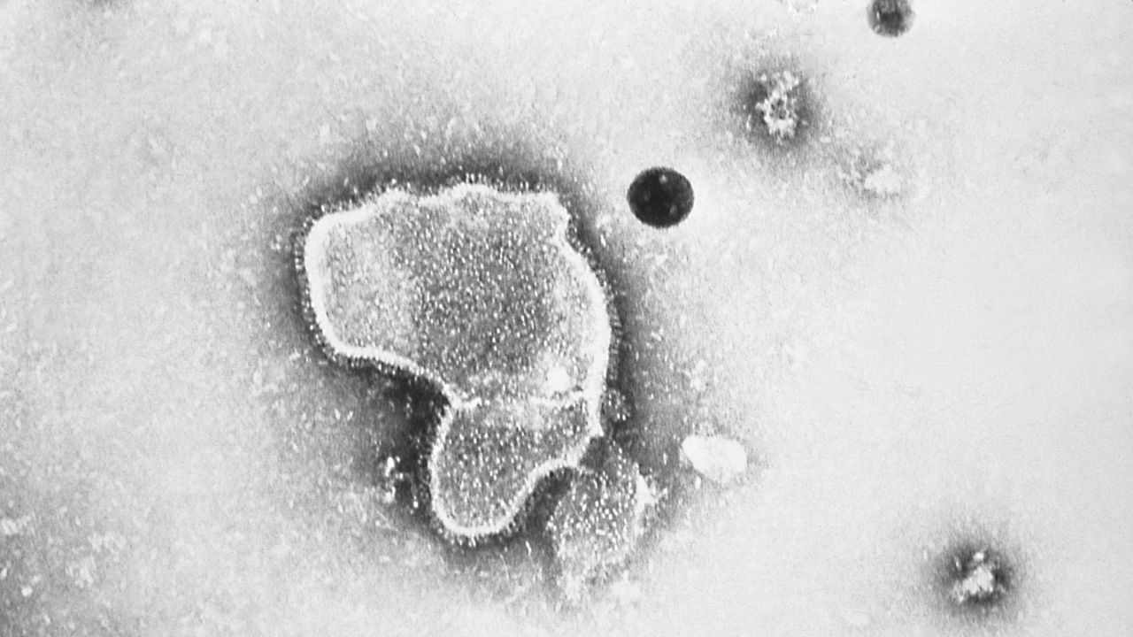 This 1981 photo provided by the Centers for Disease Control and Prevention shows an electron micrograph of Respiratory Syncytial Virus, also known as RSV. (CDC via AP, File)