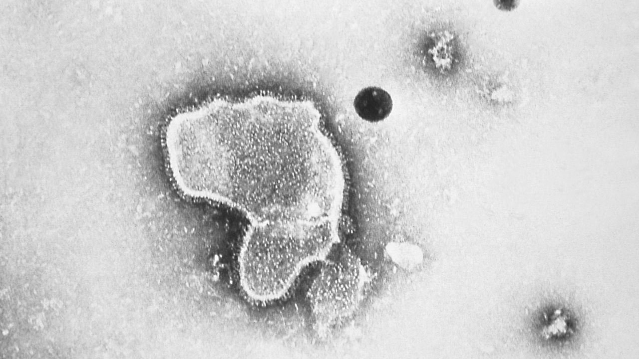 This 1981 electron microscope image provided by the Centers for Disease Control and Prevention shows a human respiratory syncytial virus, also known as RSV. (CDC via AP)