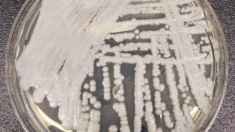 FILE - This 2016 photo made available by the Centers for Disease Control and Prevention shows a strain of Candida auris cultured in a petri dish at a CDC laboratory. (Shawn Lockhart/CDC via AP)