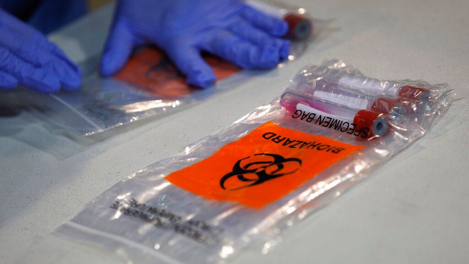 UW-Oshkosh Bet On Antigen Tests. Now, It’s Helping The CDC Evaluate Them