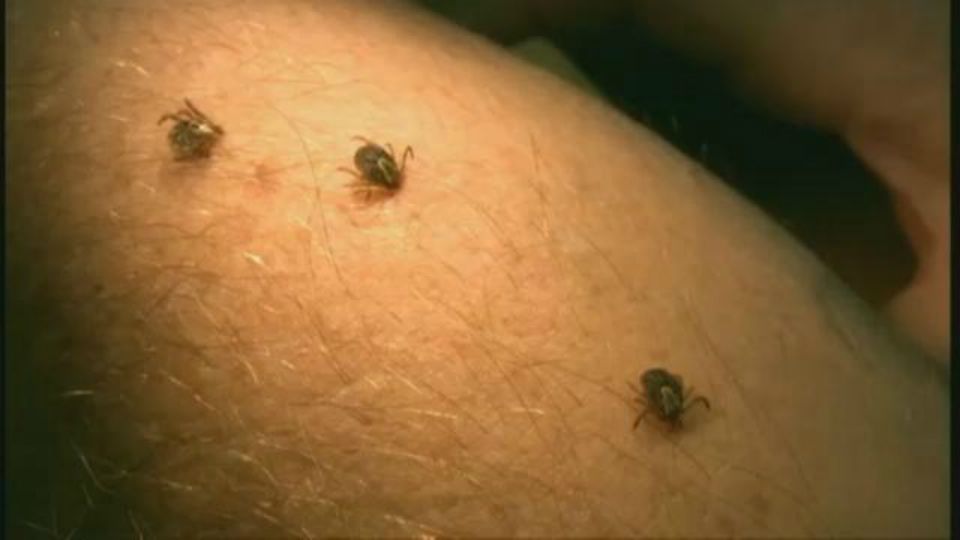 How to Treat and Prevent Ticks