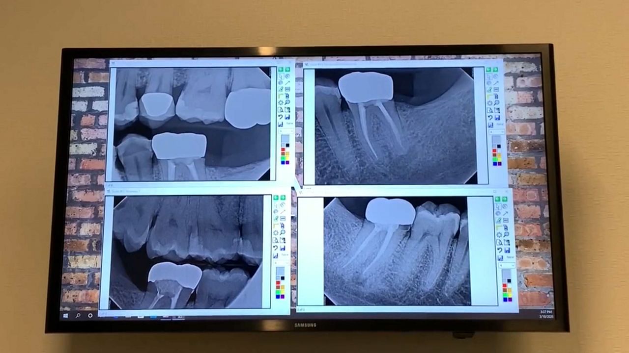 U of R study on opioid alternatives for dental procedures