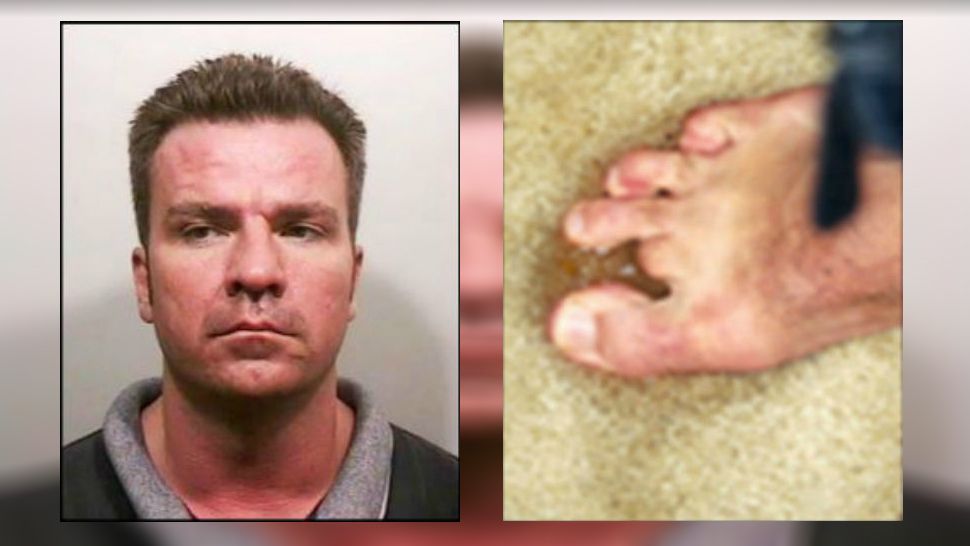 A Texas fugitive who'd been on the run for more than 10 years has been arrested and identified with the help of his missing toe. (Courtesy: U.S. Marshal's 15 Most Wanted List)