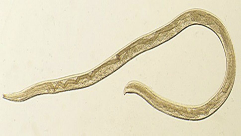 This undated photo provided by the Centers for Disease Control and Prevention (CDC) shows Thelazia gulosa, a type of eye worm seen in cattle in the northern United States and southern Canada, but never before in humans. (CDC via AP)