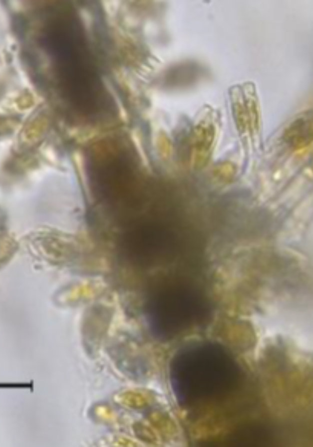 Epiphytic diatoms Gomphonema attached to Microspora 