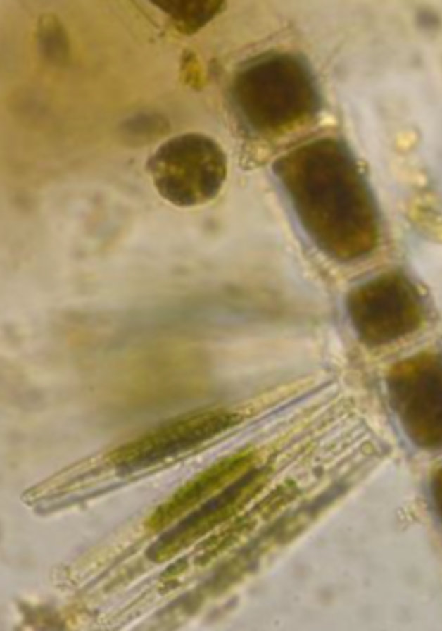 Epiphytic diatoms Synedra attached to Microspora