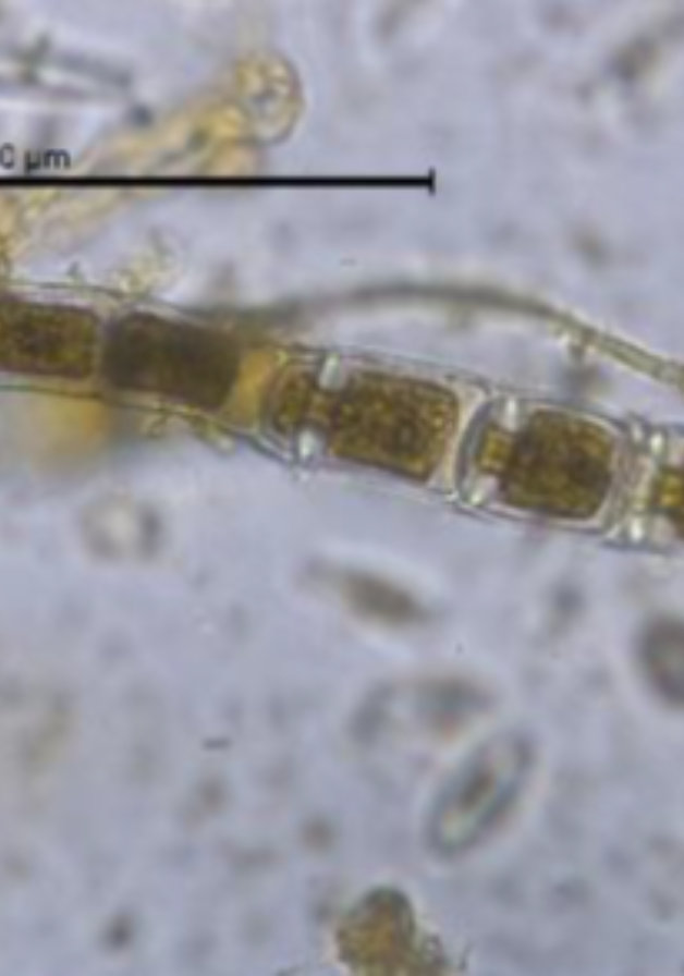 Filamentous green algae Microspora 