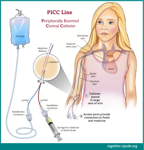 Double Lumen Picc Line Diagram